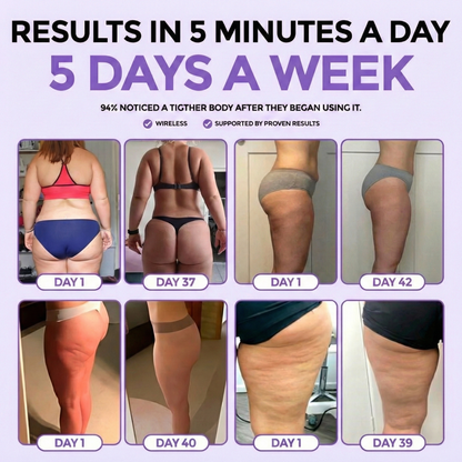 4-in-1 Cellulite Device